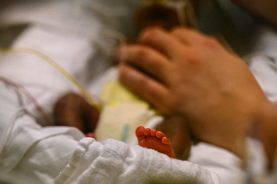 Te vroeg geboren baby in een ziekenhuisbed, hand van een ouder op het lijfje.