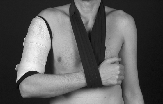 Persoon met een bovenarmbrace