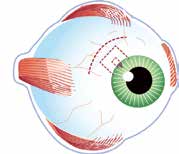 Afbeelding van een oog