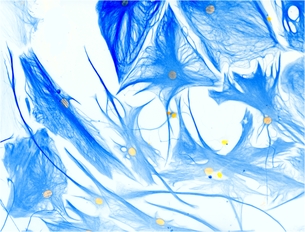 GliaNed September 14, 2022