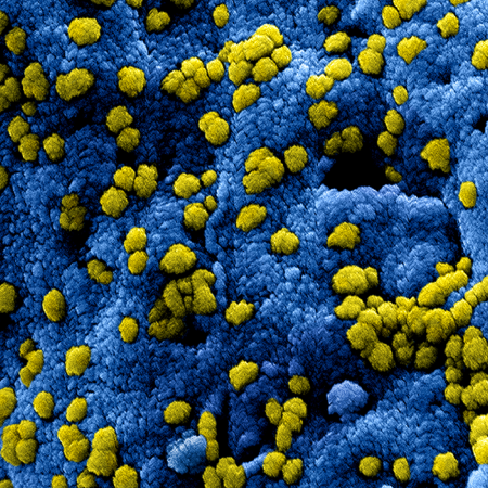 Virus
