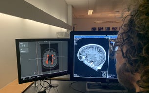 IMAGR assisteert radioloog met AI
