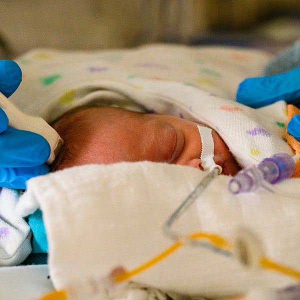 Een echo maken van de hersenen van een baby