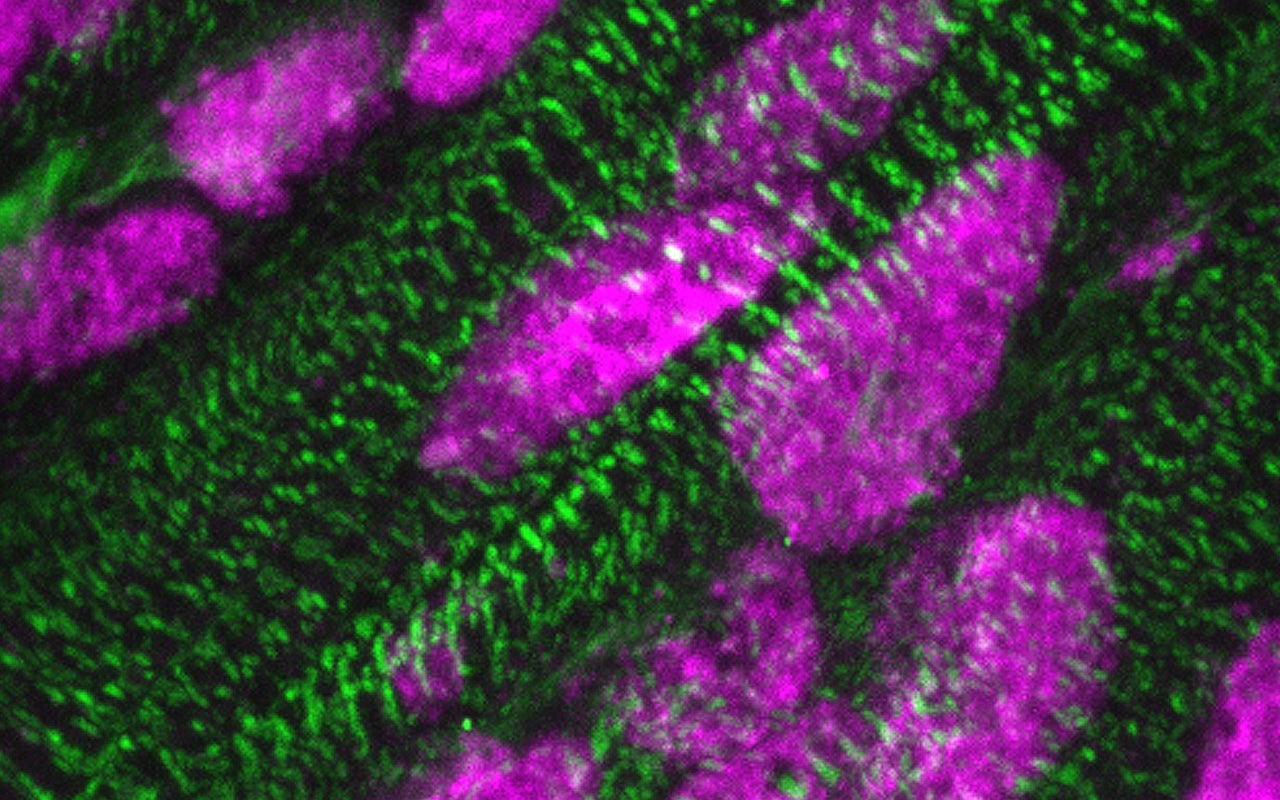 Presence of ARID1A (pink) in the nuclei of cardiac muscle cells (green), a few days after birth