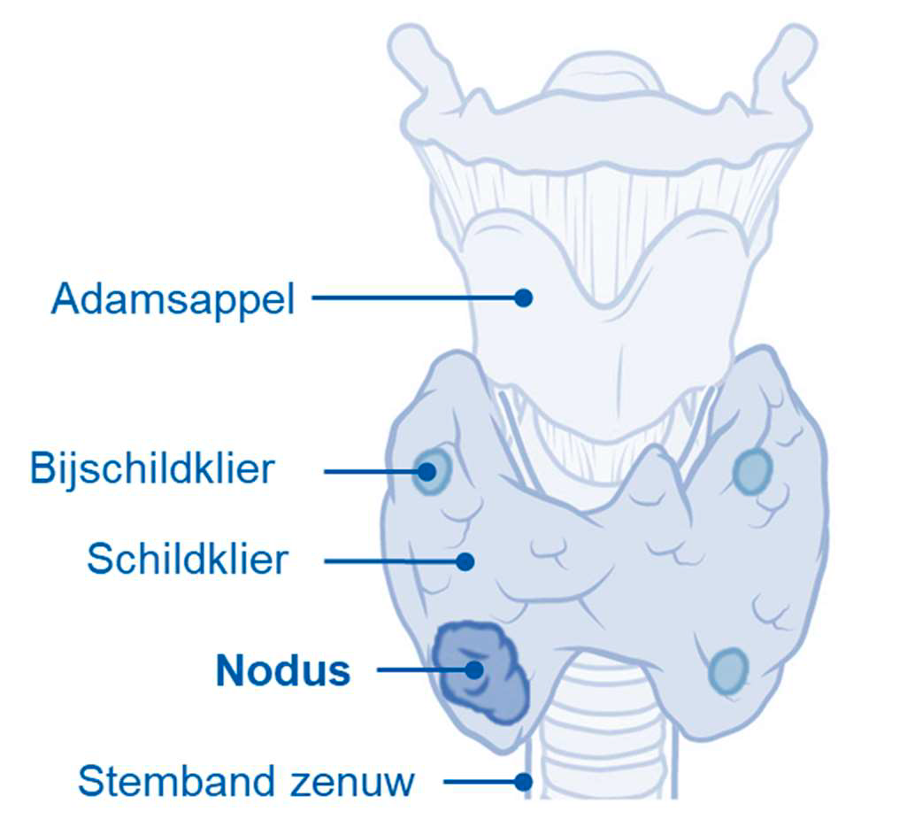 Generieke content afbeelding