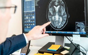Beoordeling MRI hersenen