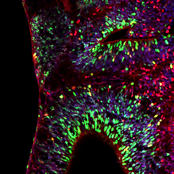 Organoid newborn
