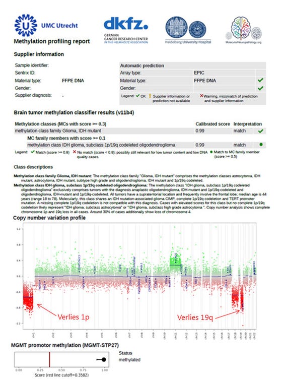 Voorbeeld van een methylatie array rapport van een oligodendroglioom met verlies van chromosoom 1p en 19q en methylatie van MGMT.