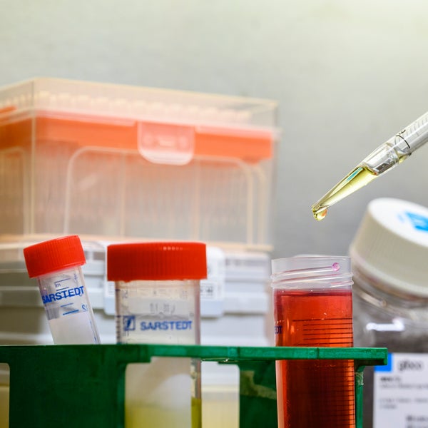 Buisjes pipetteren voor research