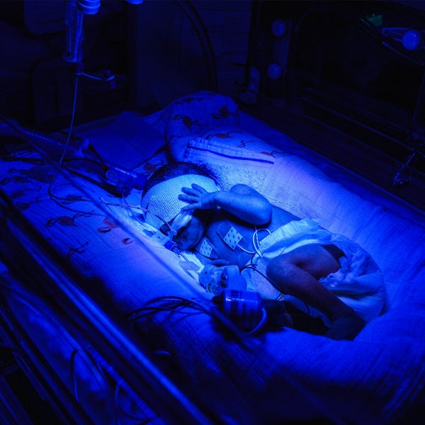Baby couveuse blauw licht