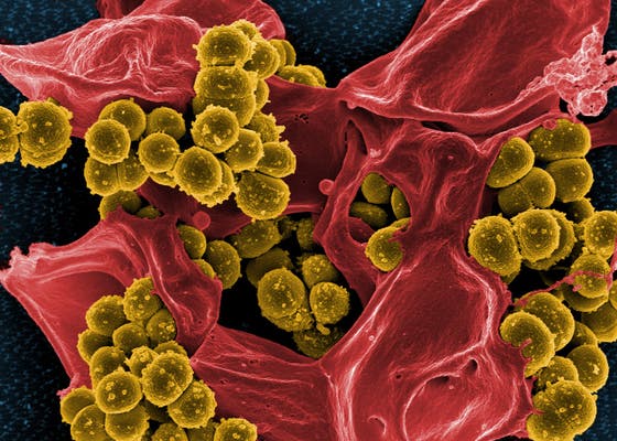 Staphylococcus aureus