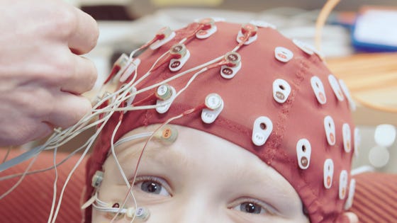 EEG meting